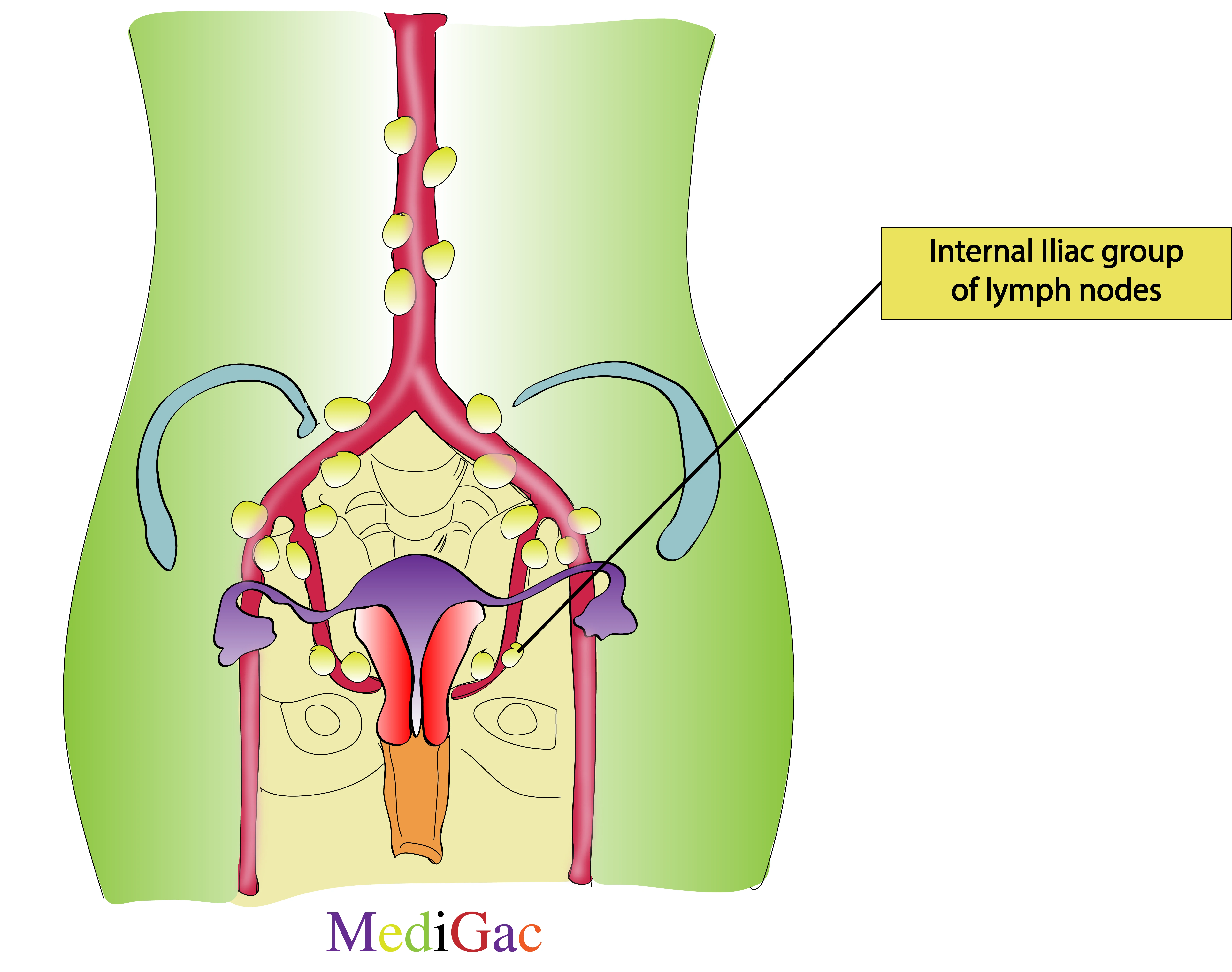 Internal iliac lymph nodes